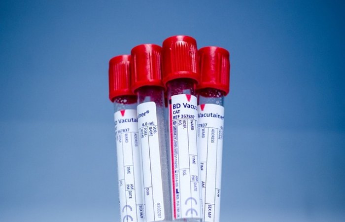 What is the EMM-negative blood group?